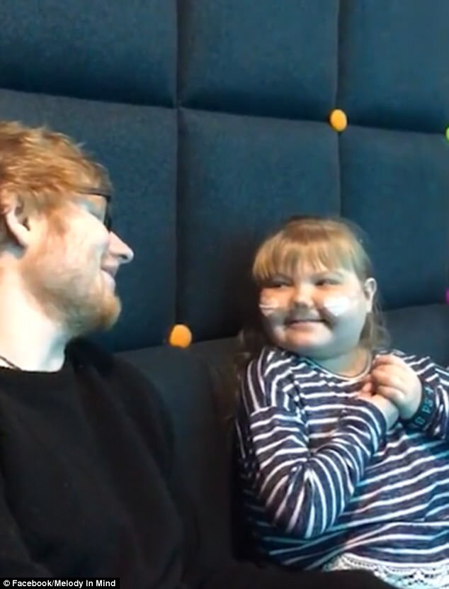 희귀 뇌질환을 가진 팬을 위해 1:1콘서트 해준 에드시런 | 인스티즈