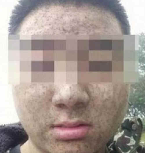 자동차 배기구에 코들이밀고 사는 수준의 중국 대기오염 | 인스티즈
