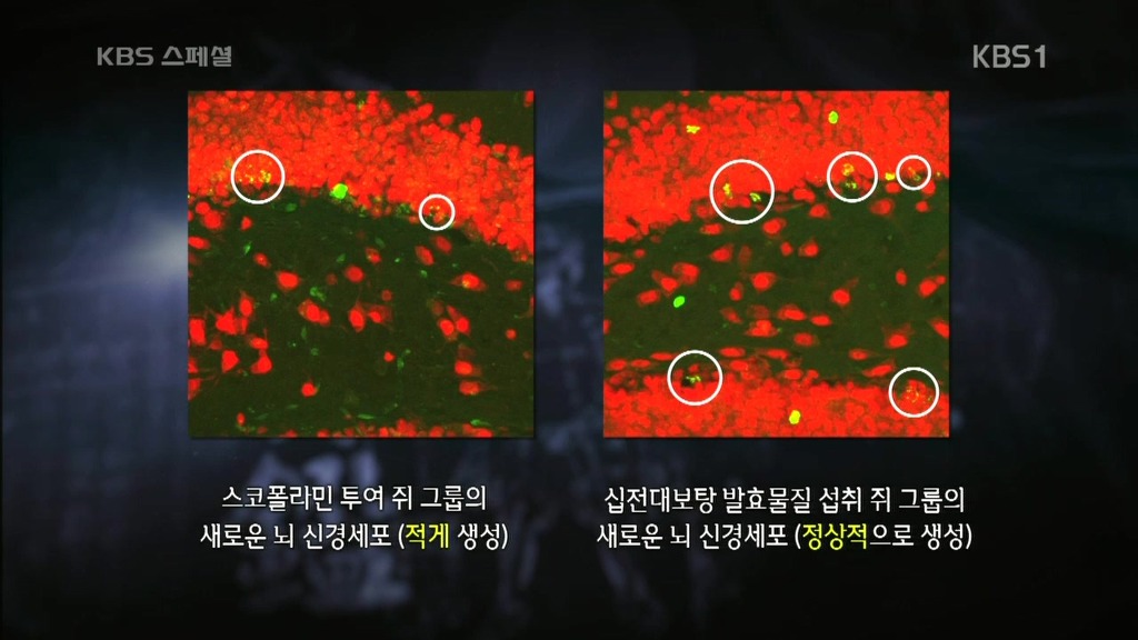 세계가 말하는 한의학과 동의보감 | 인스티즈