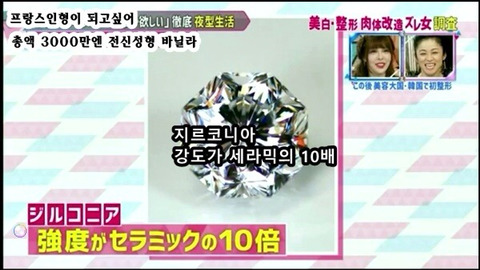 프랑스 인형이 되고싶어 총액 3000만엔 전신성형한 바닐라 | 인스티즈